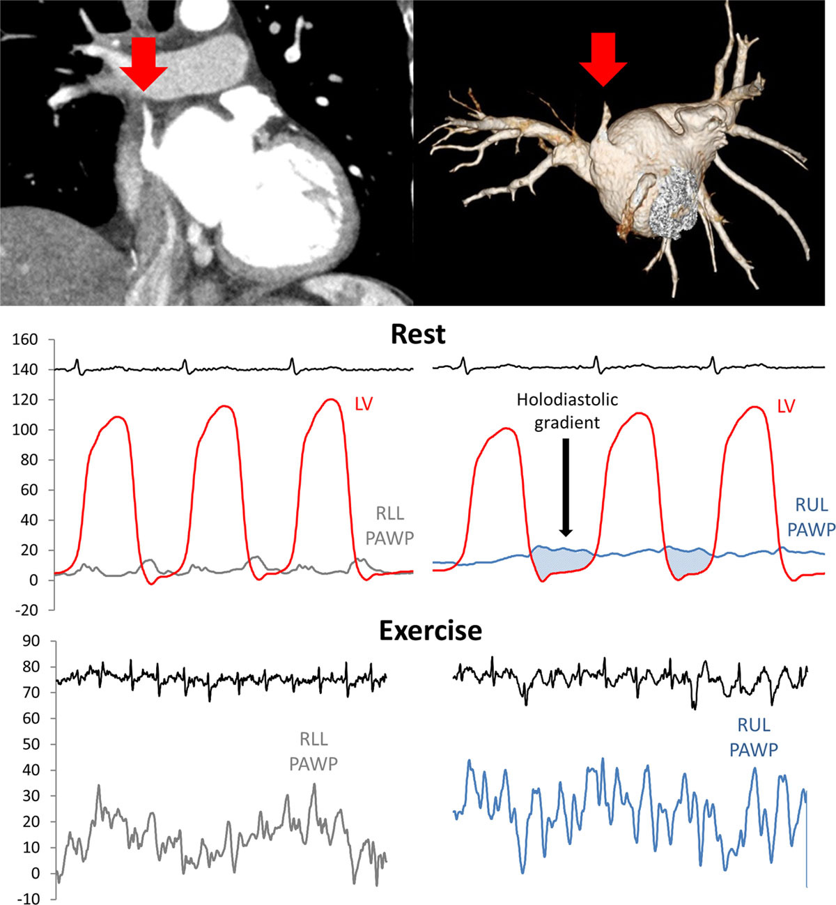 Journal of Cardiovascular Emergencies